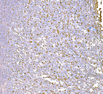 Anti-SND1 Antibody (monoclonal, 5F5E9)