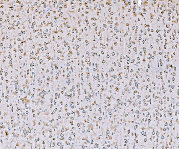 Anti-SND1 Antibody (monoclonal, 5F5E9)