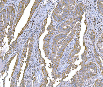 Anti-SND1 Antibody (monoclonal, 6G3B4)
