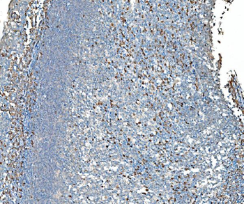 Anti-SND1 Antibody (monoclonal, 6G3B4)