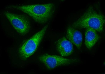 Anti-EPRS1/PARS Antibody (monoclonal, 12B5B3)