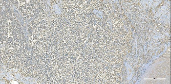Anti-EPRS1/PARS Antibody (monoclonal, 12B5B3)