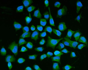 Anti-Semaphorin 3B/SEMA3B Antibody (monoclonal, 9C4F7)