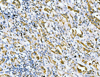 Anti-Filamin B/FLNB Antibody (monoclonal, 11E2D2)