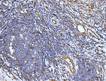 Anti-Filamin B/FLNB Antibody (monoclonal, 11E2D2)