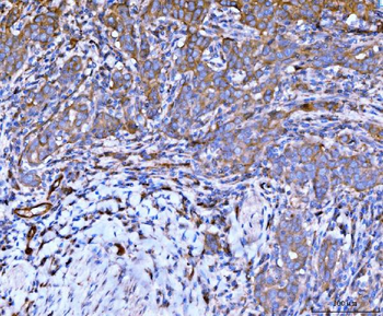 Anti-Filamin B/FLNB Antibody (monoclonal, 11E2D2)