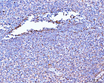 Anti-Filamin B/FLNB Antibody (monoclonal, 11E2D2)