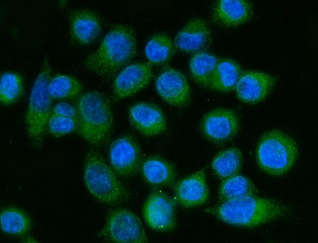 Anti-FACL4/ACSL4 Antibody (monoclonal, 4I7)