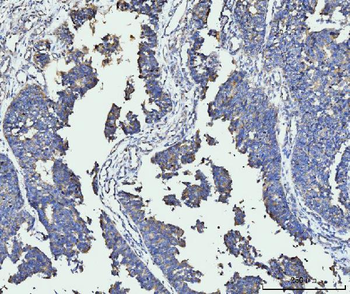 Anti-FACL4/ACSL4 Antibody (monoclonal, 4I7)