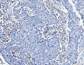 Anti-FACL4/ACSL4 Antibody (monoclonal, 4I7)