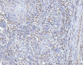 Anti-FACL4/ACSL4 Antibody (monoclonal, 4I7)
