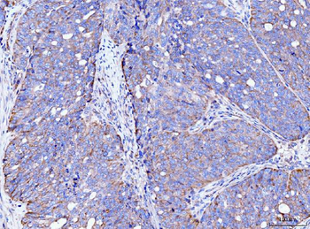 Anti-FACL4/ACSL4 Antibody (monoclonal, 4I7)