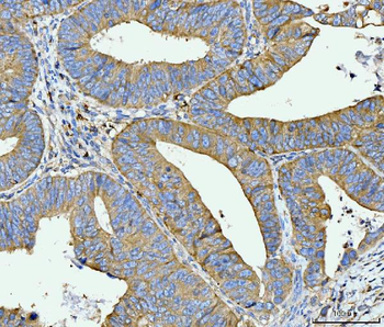 Anti-FACL4/ACSL4 Antibody (monoclonal, 4I7)