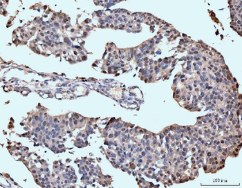 Anti-Neurofibromin/NF1 Antibody (monoclonal, 4C6F10)