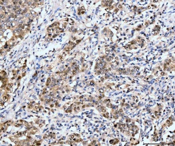 Neurofibromin/NF1 Antibody (monoclonal, 4C6F10)