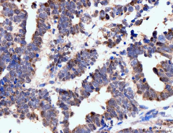Anti-Neurofibromin/NF1 Antibody (monoclonal, 4C6F10)