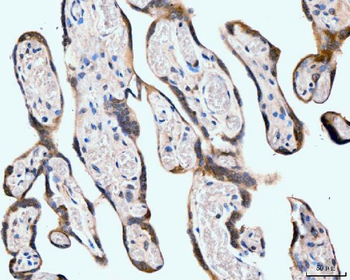 Anti-Neurofibromin/NF1 Antibody (monoclonal, 4C6F10)