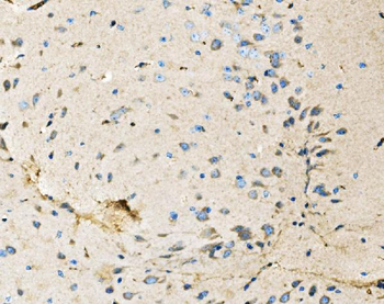 Anti-Neurofibromin/NF1 Antibody (monoclonal, 4C6F10)