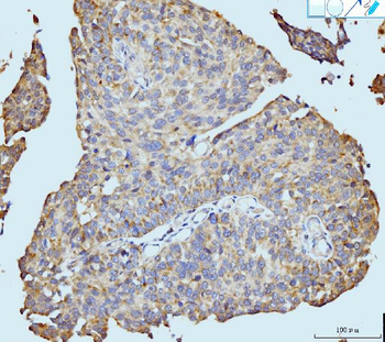 Anti-Neurofibromin/NF1 Antibody (monoclonal, 4F8B7)