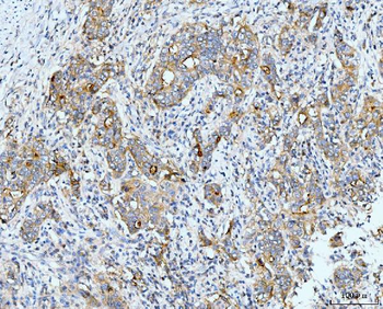 Anti-Neurofibromin/NF1 Antibody (monoclonal, 4F8B7)