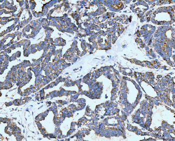 Anti-Neurofibromin/NF1 Antibody (monoclonal, 4F8B7)