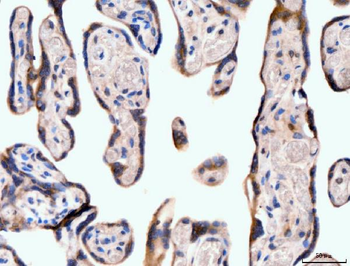 Anti-Neurofibromin/NF1 Antibody (monoclonal, 4F8B7)