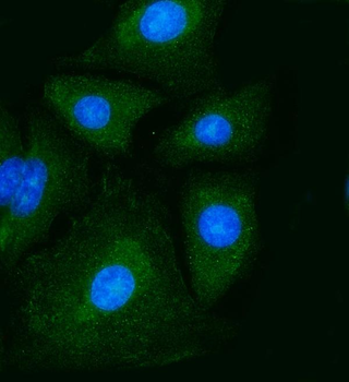 Anti-PKM2 Antibody (monoclonal, 11I4C3)