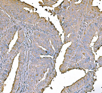 Anti-PKM2 Antibody (monoclonal, 11I4C3)