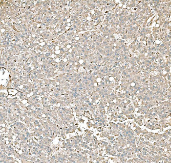 Anti-PKM2 Antibody (monoclonal, 11I4C3)