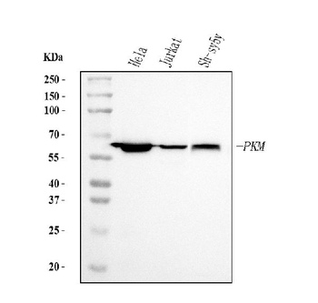 Anti-PKM2 Antibody (monoclonal, 11I4C3)