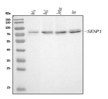 SENP1 Mouse Monoclonal Antibody