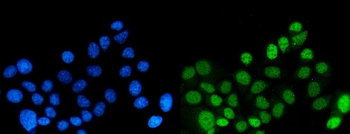 Anti-DYNLL1/PIN Antibody (monoclonal, 6G2H1)