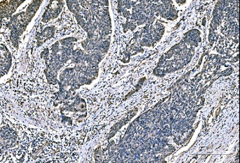 Anti-DYNLL1/PIN Antibody (monoclonal, 6G2H1)