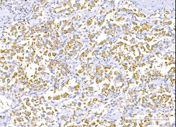 Anti-RALBP1 Antibody (monoclonal, 2F9D3)