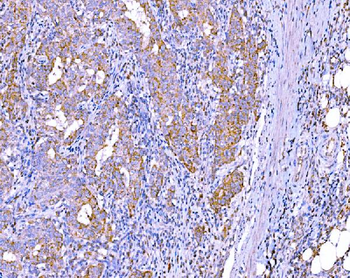 Anti-RALBP1 Antibody (monoclonal, 2F9D3)