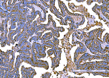 Anti-RALBP1 Antibody (monoclonal, 2F9D3)
