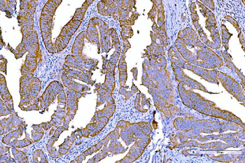 Anti-RALBP1 Antibody (monoclonal, 2F9D3)
