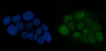 ATR Rabbit Polyclonal Antibody