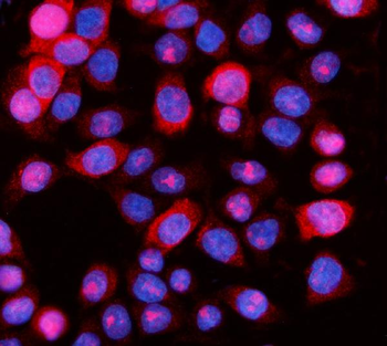 Anti-Aurora A/AURKA Antibody