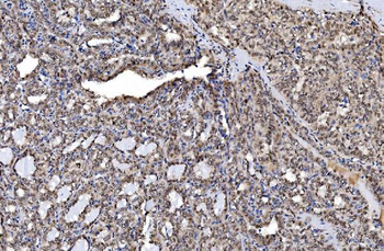 Anti-Aurora A/AURKA Antibody