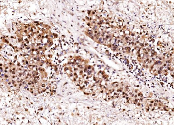 Anti-Aurora A/AURKA Antibody