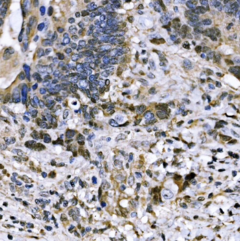 Anti-BUB1 Antibody