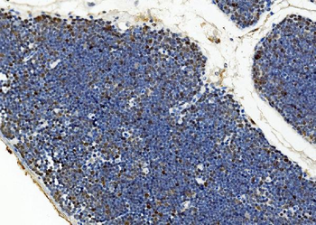 BUB1 Antibody