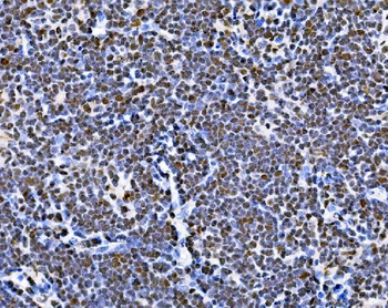 Anti-BUB1 Antibody
