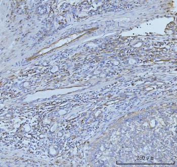 Anti-CD93 Antibody