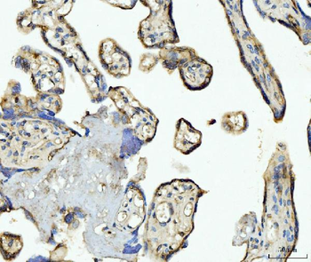 Anti-CD93 Antibody