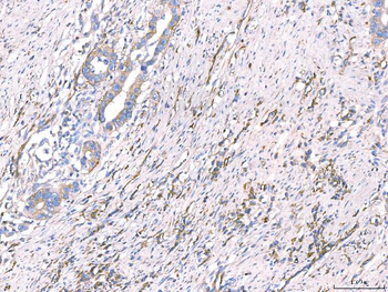 Anti-CD93 Antibody