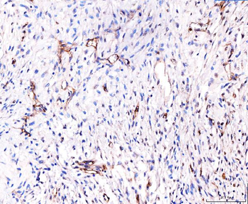 Anti-CD93 Antibody