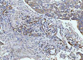 Anti-CD93 Antibody