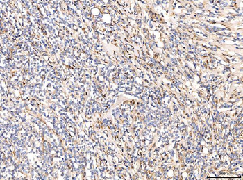 Anti-CD93 Antibody